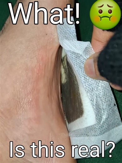 I tried this foot detox patch on my feet for one night and the result shocked me 😳 Does this really remove toxins or is it a scam? Watch till the end 👀 Would YOU try this? Comment below ⬇️ #HealthyLife #health #shorts #youtubeshorts #viral