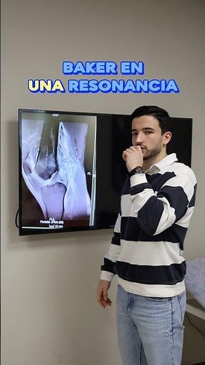 👀Acompáñame a entender qué es y cómo se ve un quiste de Baker