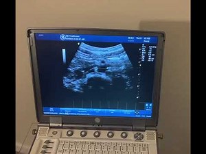 Ultrasound Imaging of the Abdominal Aorta