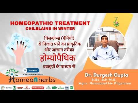 Chilblains in Winter? Best Homeopathic Medicines for Fast Relief || Homeonherbs #chilblains