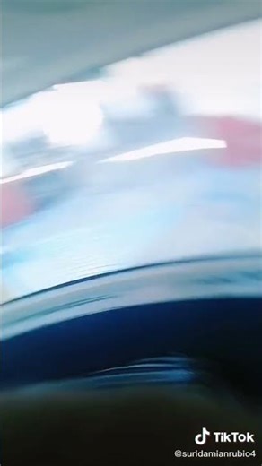 LONG ARM CAST WOMAN #gesso #cast #brazo