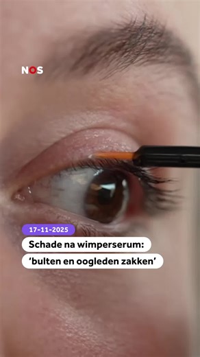Je kunt behoorlijk wat bijwerkingen krijgen van wimperserums. #wimperserum #nosstories