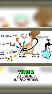 2-Minute: Gigantism & Acromegaly | Growth Hormone, Signs & Symptoms, Treatment