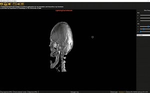 医学影像是怎么做的？医学影像数据可视化_LightningChart数据可视化控件