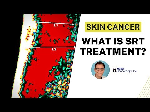 Image-Guided Superficial Radiotherapy (SRT) | Mohs Surgery Alternative | Robert Haber, MD