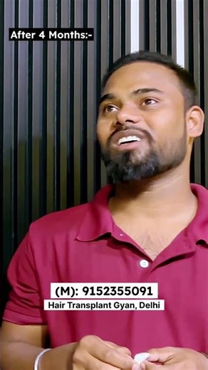 Dhappa Song | Hair Transplant Result in 4 Months Only #shorts