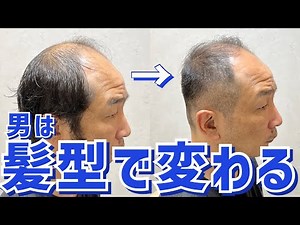 【薄毛】頭頂部はげがベリーショートで大変身‼︎