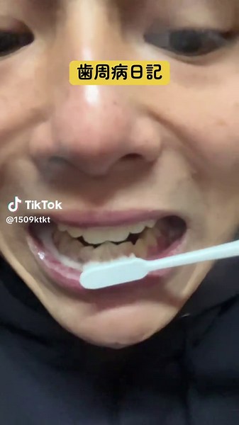 歯周病治療に役立つフロスの使い方