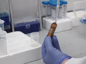 An Integrated Platform for Genome-wide Mapping of Chromatin States Using High-throughput ChIP-sequencing in Tumor Tissues