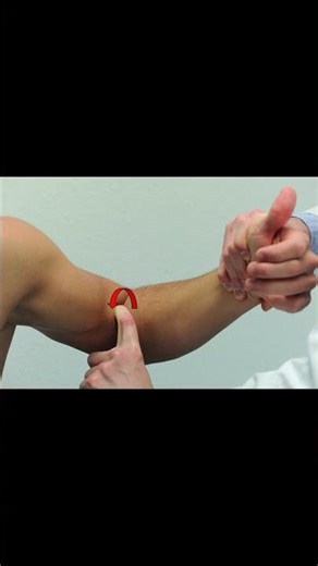 Hook Test for Distal Biceps Tear 🦴 #elbowpain #meded #ortho #physio #ATC #anatomy