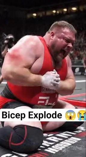 "Horrific Strongman Bicep Tear During Massive Atlas Stone Lift – Insane Injury Fail! 😱" #shorts