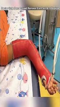 Doctor Help Poor Little Boy Cutting Cast Broken Arm 😱 #castremoval #cutting #help #patient #brokenar