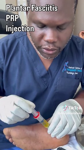Effective PRP Injection for Chronic Heel Pain Relief