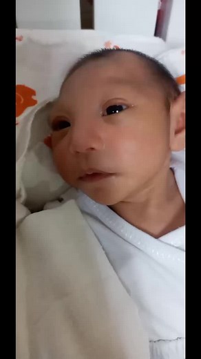 Microcephaly vs Macrocephaly in Babies