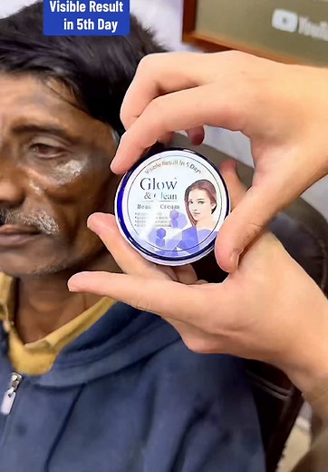 Best Face Whitening Cream for Anti-Aging Benefits