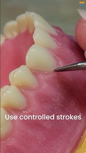 How to Use a Wax Knife Like a Pro! #shorts #dentist #video