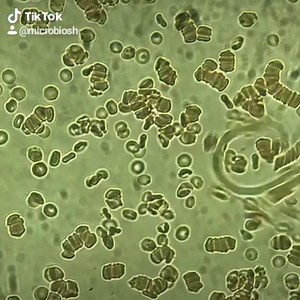 16K views · 578 reactions | Dirofilaria immitis, también conocida...