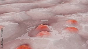 face Acne and Pimples and blackhead growth and spreading uncontrollably because of sebaceous glands, Oily Skin Layer, Clogged pores, whiteheads and papule and pustule and cyst and nodules, 3d render Stock Video