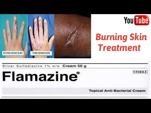 How to Use Flamazine Cream for Burns and Wounds | Medical Guide