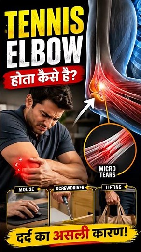 How Does Tennis Elbow Happen?