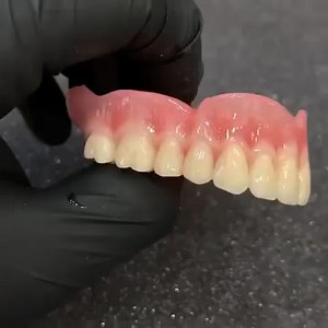 🎁 Biggest Sale of the Year! 🎁 🎄This Christmas season, let your smile shine like the holidays! ✨ Our revolutionary adjustable full dentures let you eat, speak, and smile with confidence. Enjoy comfortable, unrestricted chewing, clear and fluent speech, and a confident, radiant smile. No adhesives needed—our dentures fit your gums perfectly, forming a vacuum seal for comfortable and natural wear all day. Plus, they can be easily installed at home, giving you a captivating smile quickly! Get bet