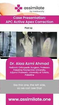 Case Presentation APC Active Apex Correction