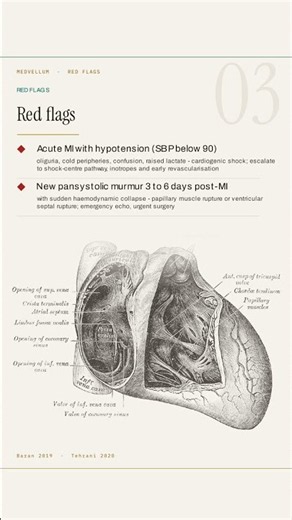 Cardiogenic Shock: The Warning Signs Before Collapse