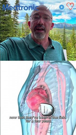 Where is defibrillation headed next? ‪@MedtronicCardiacandVascular‬