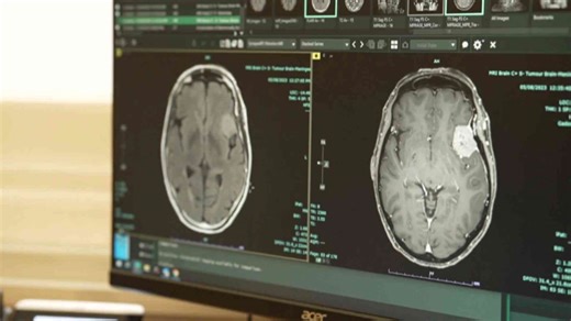 Pfizer faces possible class action after contraceptive Depo-Provera linked to brain tumours