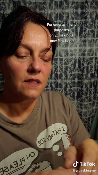 DIY Temporary Teeth Replacement Using Instamorph