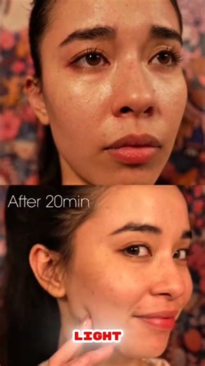 LED Light Therapy Mask: The 10-Minute Skincare Hack That Destroys Acne & Boosts Collagen