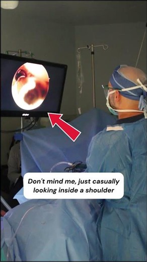 We Put A Camera Inside A Shoulder And Found This...