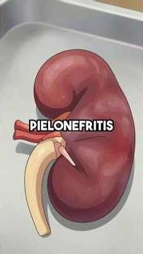 Una infección urinaria puede desvivirte. Esto es lo que nadie te dice. #Urgencias #Riñones #Sepsis