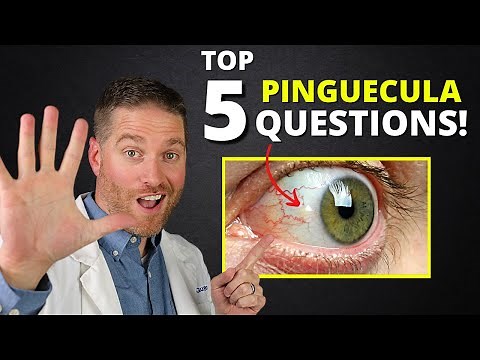 Yellow Spot On Your Eye (Pinguecula) - Top 5 Questions Answered!