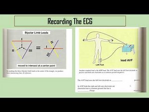 EINTHOVENS TRIANGLE AND BASIC OF LEADS OF ECG 3