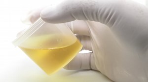 Researchers harness human urine to make products in space