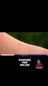 Bill Gates' Secret Plan: Code Red for Population Control Part 6 | The African Story