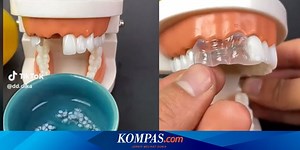 Beredar Video Tambal Gigi Hanya dengan "Gel Temporary Tooth", Amankah?