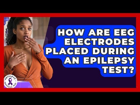 How Are EEG Electrodes Placed During An Epilepsy Test? - Epilepsy Wellness Hub