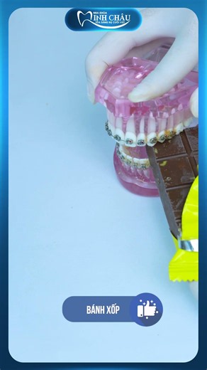 What to Eat with Braces? | Minh Chau Dental