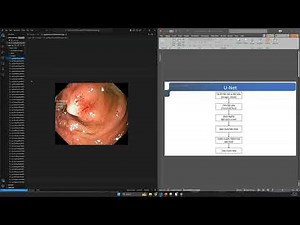 Hướng Dẫn Xây Dựng & Code Mô Hình U-Net Từ Cơ Bản | Deep Learning & Computer Vision (Phần 1)