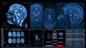 MRI brain scanning animation. Neurology data, vital signs on display Future technology. HUD, interface.