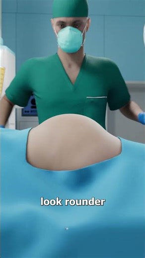 Why Rich People Inject Dead People’s Fat 😬