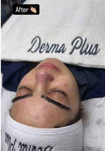 ‏Day 1 our case for today 👌