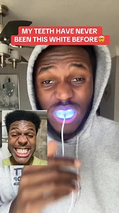 1.1K views | Whiter teeth in just minutes a day! ⏳醴 The Snow Wired Diamond LED Whitening Kit uses advanced LED light technology and powerful whitening serum to erase stains and brighten your smile effortlessly. #teethwhitening #whiteningkit #teethcare #addtocart #shinebright | SNOW Teeth Whitening | Facebook