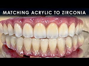 How to Match an Acrylic Denture to a Zirconia Arch