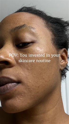 As I get older clear skin, great health, and peace is all I need. Thank you @illuminatedbeauty_skincareden 💖✨ #craftymama #clearskin #skincareroutine #millenialmom | Crafts_bycamille