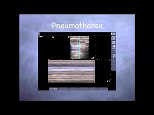 Tutorial: Lung Ultrasound