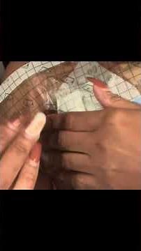 Yes I Shower with my catheter #kidneydialysis #kidneydisease #kidneyfailure #cathetercare