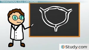 Bladder Cancer: Symptoms and Treatments - Video | Study.com